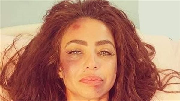 دوللي شاهين