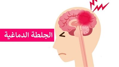 أعراض ما بعد الجلطة الدماغية وكيفية التعامل معها