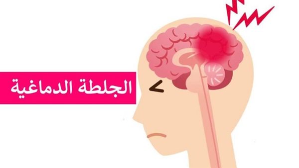 أعراض ما بعد الجلطة