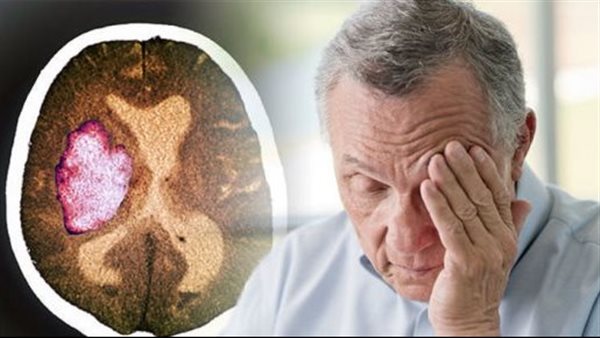 علاج الجلطة الدماغية