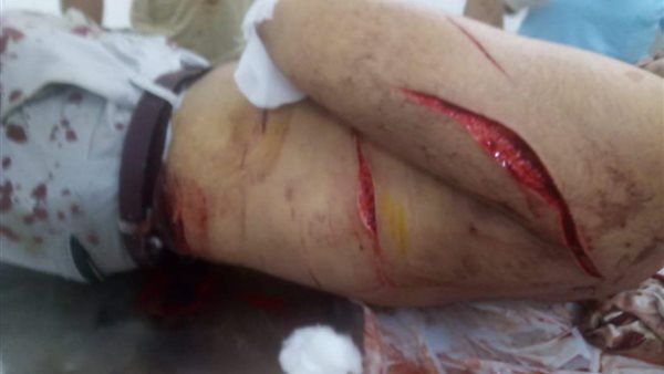 التعدي على شاب بالفيوم