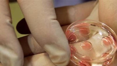 قصة طبيب مع الشيخ «جاد الحق» حول فتوى «أطفال الأنابيب» (فيديو)