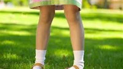 علاج تقوس الساقين عند الأطفال والكبار بالطرق الطبيعية والجراحية