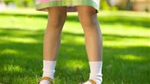 علاج تقوس الساقين