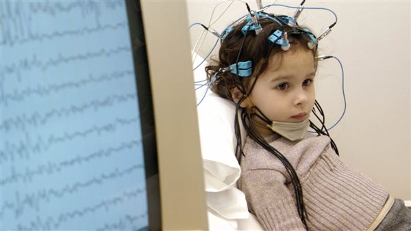 الصرع عند الأطفال