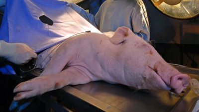 جراح بيطري عن تجربة نقل كلية خنزير إلى جسم إنسان: مرحب بكل علم جديد ينقذ البشر