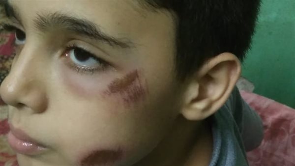 الطالب يوسف