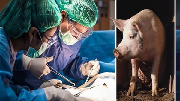 زراعة كلية خنزير