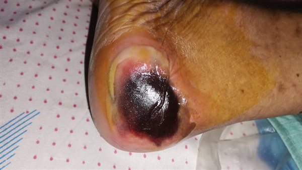 استغاثة بوزارة الصحة