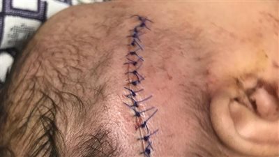 القاسية قلوبهم.. أب متهم بإصابة رضيعته بآلة حادة خلال مشاجرة أسرية بالمنوفية