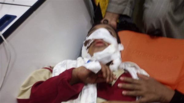 أحد الأطفال المصابين