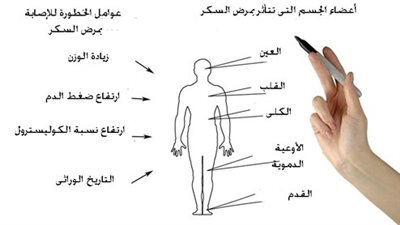 مضاعفات مرض السكر النوع الأول.. متى تحدث وكيف تظهر على المصاب؟