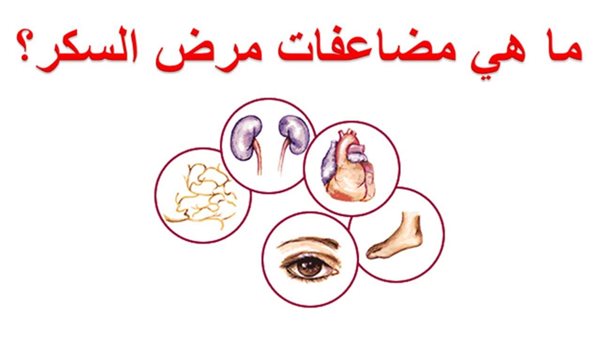 مضاعفات مرض السكر