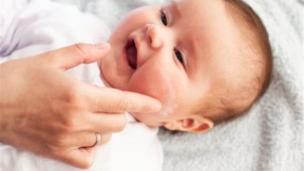 أسباب البهاق عند