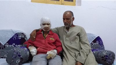 والد الطفل يحيى بسوهاج بعد تعرضه للحرق: بعت العربية والحمار عشان أعالج ابني