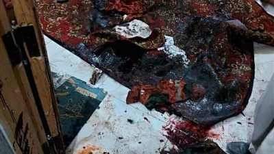 بسبب خلافات زوجية.. ضبط شاب سكب مياه نار علي زوجته وأسرتها بكفر الشيخ