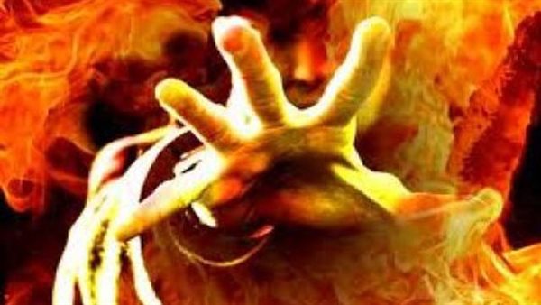 رجل محترق-أرشيفية