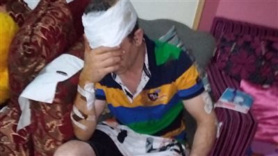 حاول إبعادهم عن نجله.. 15 شخصا يتعدون على صاحب محل بالإسكندرية | صور