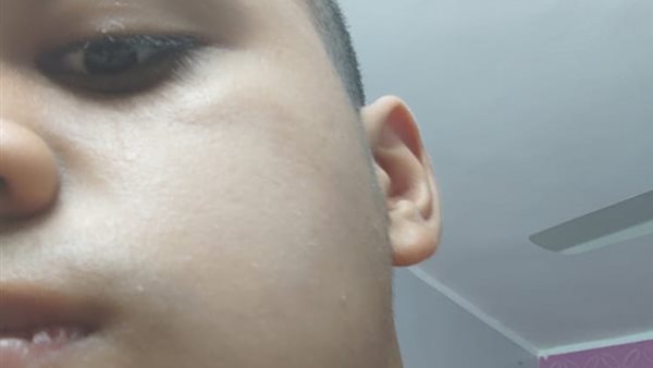 الطالب المصاب