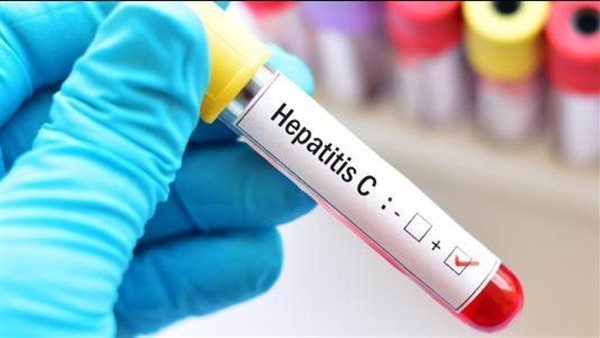 اختبار فيروس سي