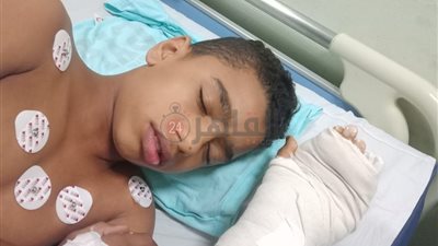 بسبب بيتزا.. طالب يتعدى على زميله بسلاح أبيض داخل مدرسة بمدينة نصر | فيديو