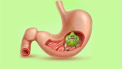 بإضافة العسل والخل والزبادي.. خطوات علاج جرثومة المعدة بالثوم 