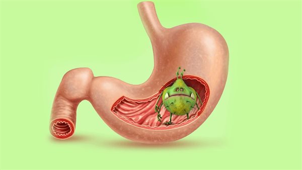 علاج جرثومة المعدة