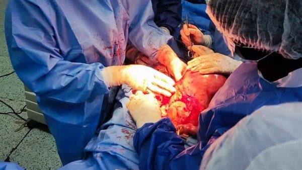 جانب من العملية