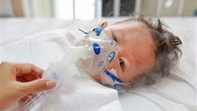 فيروس RSV معدي وسريع الانتشار ويصيب الأطفال.. الأعراض وطرق الوقاية
