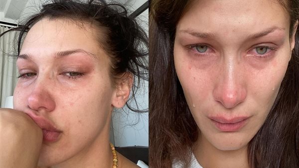 أزمة بيلا حديد وزين