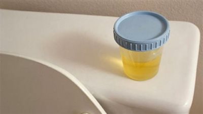 تغيير اللون والرائحة.. علامات الحمل من البول وكيفية اكتشافها