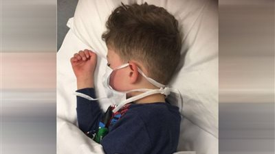 تحذير الصحة من مرض الأطفال RSV: التوجه العاجل للطبيب في هذه الحالة
