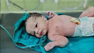 حالتا ولادة قيصرية لسيدتين مصابتين بكورونا بمستشفى حجر كفر الدوار