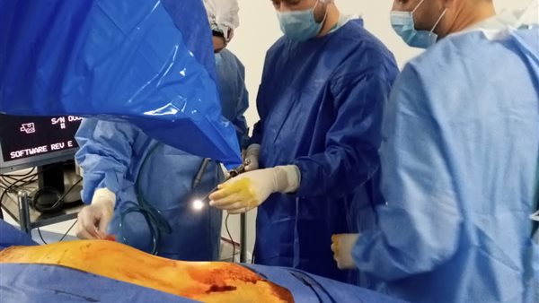 جانب من الجراحة