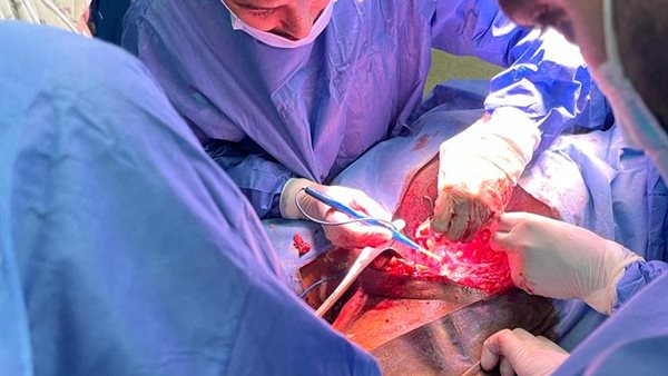 اثناء اجراء العملية