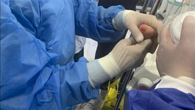 الصحة: فحص أكثر من 32 ألف طفل مبتسر خلال 4 أشهر 