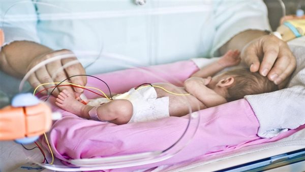 الولادة المبكرة