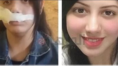 مش هخلیکي تنفعي ليا ولا لغيري.. المشدد 5 سنوات لرجل شوه وجه طليقته بكتر في القاهرة