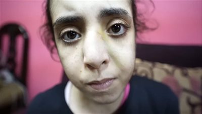 ضرب بماسورة وتجويع.. أب يتحرش بابنتيه ويعذبهما إرضاء لزوجته الثانية بالسلام | فيديو