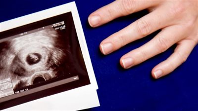  أسباب وأعراض الحمل العنقودي الخطير وموعد ظهوره بالسونار