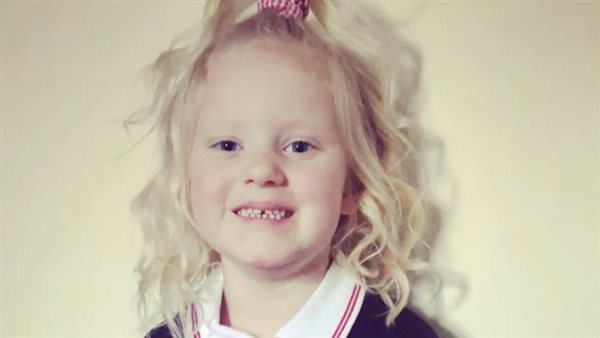 الطفلة سكايلا وايتينج