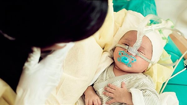 الفيروس المخلوي التنفسي