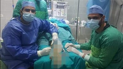 نجاح عملية إصلاح اعوجاج قدم مخلبي لطفل بمستشفى الأطفال التخصصي بالبحيرة