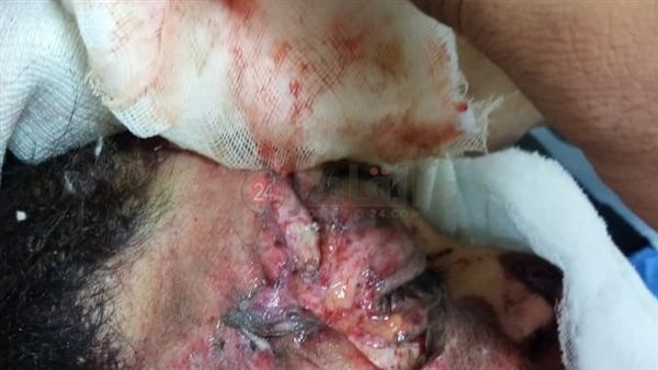 سيارة ميكروباص تطيح