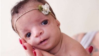 استشاري أطفال: تخطي الأم الـ 35 يزيد فرص إنجاب أجنة مشوهة 