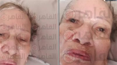 ننفرد بنشر صور الجاسوسة انشراح موسى في مستشفى تل أبيب قبل وفاتها بساعات