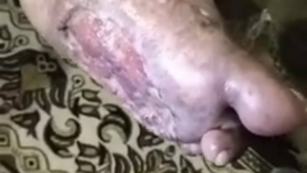 حالة المسنة