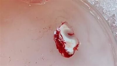 دراسة: الاحتفاظ بشريحة من الدماغ البشري طريقة جديدة لدراسة علاج الأورام