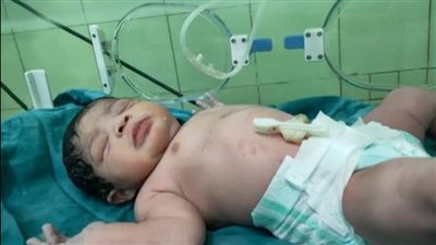 مستشفى الحجر الصحي بكفر الدوار تشهد إجراء ولادة قيصرية لسيدة مصابة بـ كورونا | صور