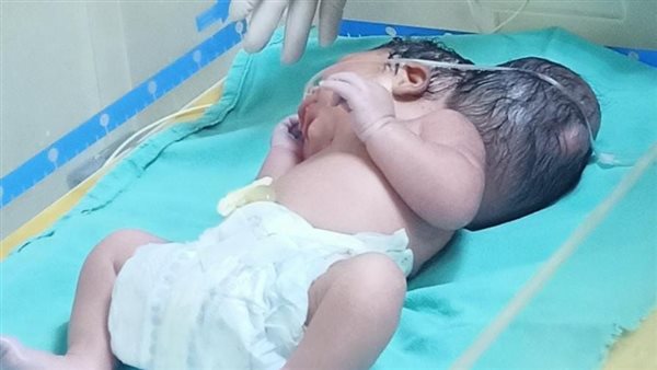 ولاده نادرة